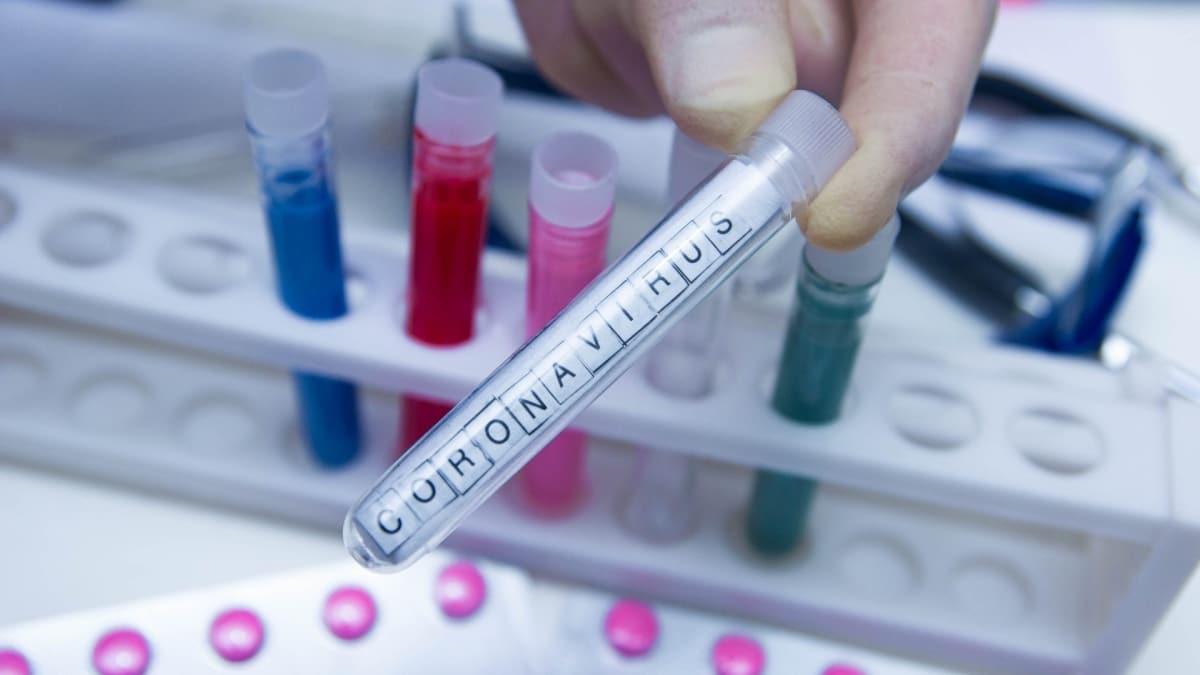 ABD Bakan Trump'tan koronavirs aklamas: 150 milyon Kovid-19 testi datlacak