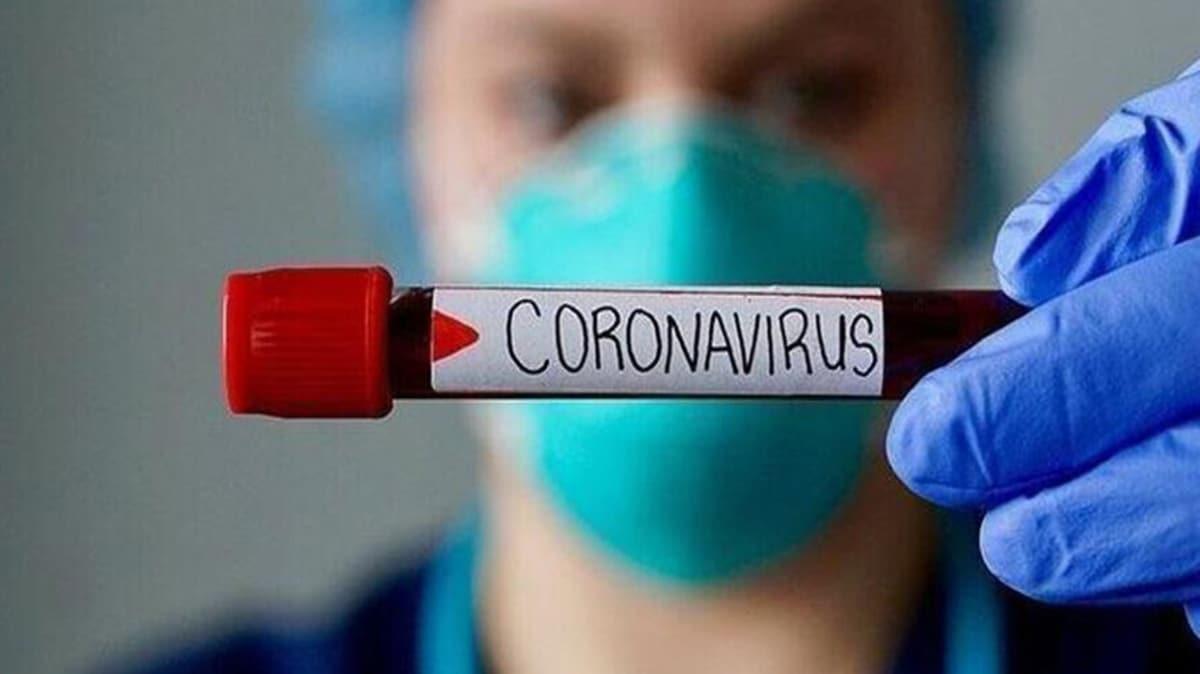 Dnya genelinde koronavirs bilanosu artyor: Yaklak 36 milyon kiide tespit edildi