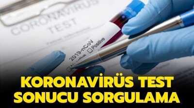Covid 19 Test Sonucu Kac Gunde Cikar Sonuclar Nasil Ogrenilir E Nabiz Covid 19 Test Sonucu Sorgulama Son Dakika Haberleri Internet