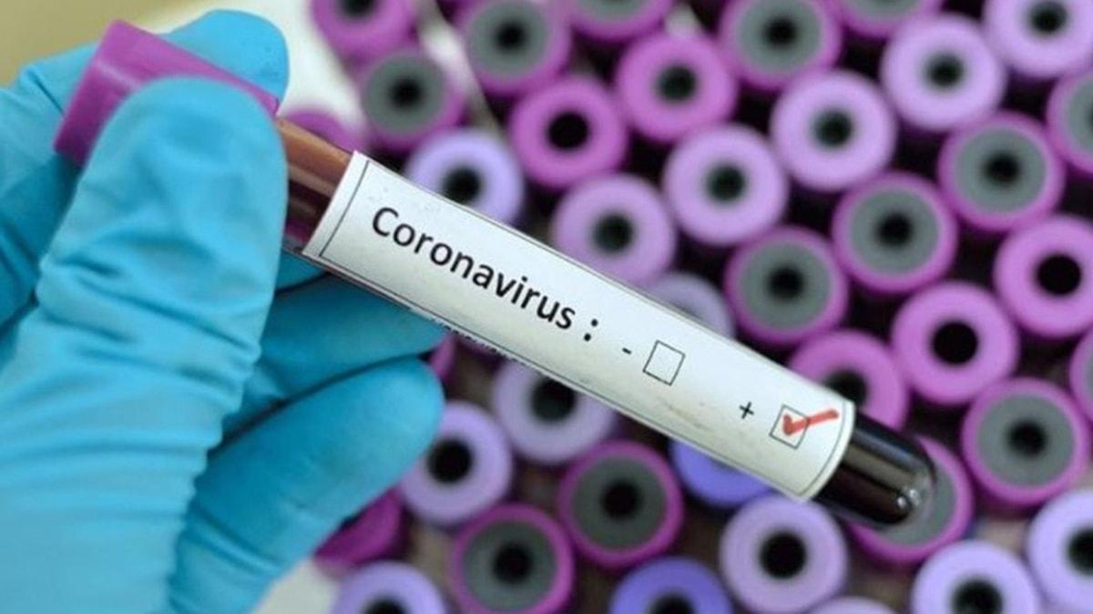 Trk bilim insanlarndan yeni koronavirs test kiti: Gargara ile tespit edilecek