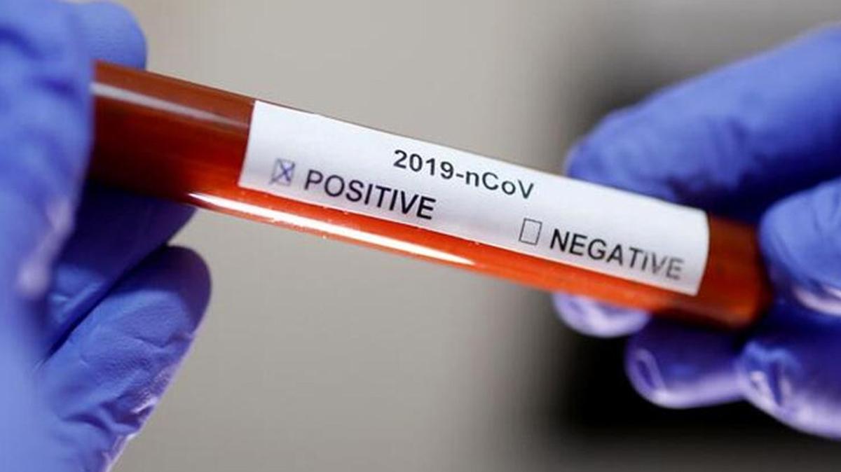 Rakamlar artyor: Dnya genelinde koronavirs tespit edilen kii says 47 milyonu geti