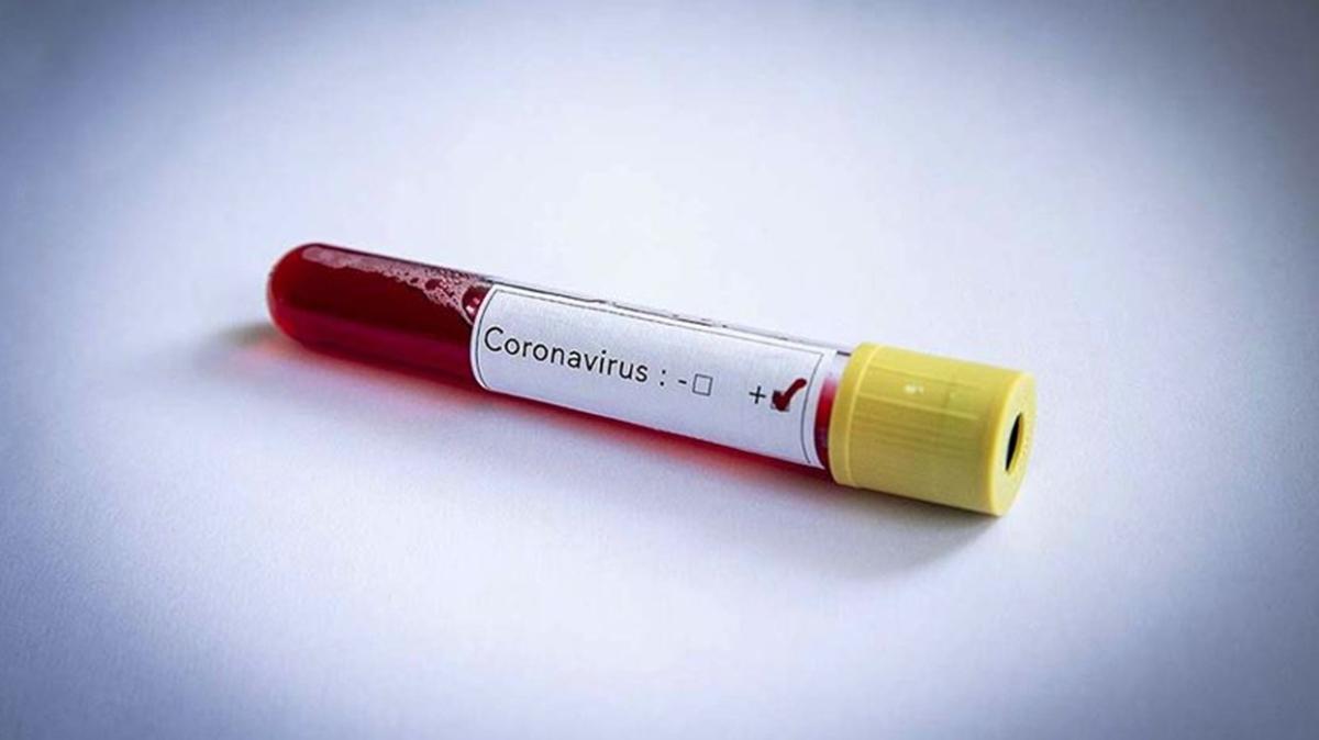 Vanuatu'da ilk koronavirs vakas tespit edildi