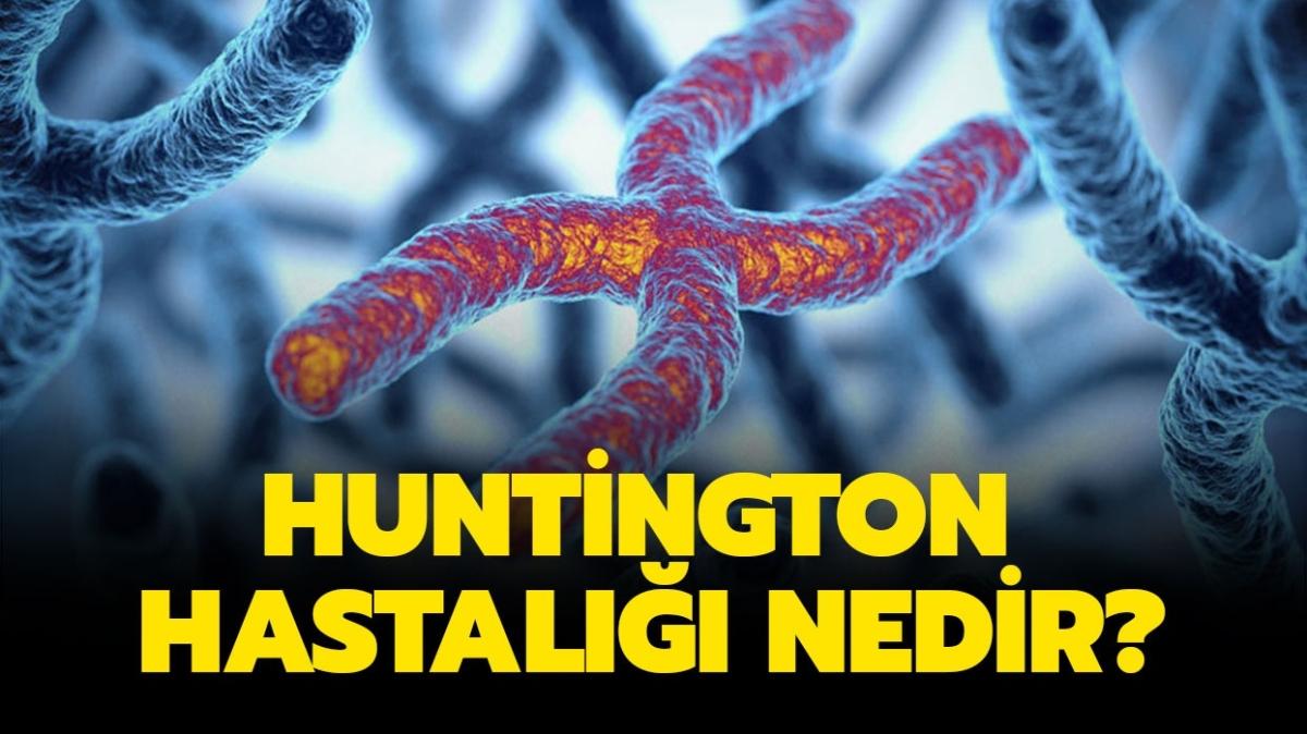 Huntington Hastalığı Nedir Belirtileri Nelerdir Huntington Hastalığı Tedavisi Var Mı 5257