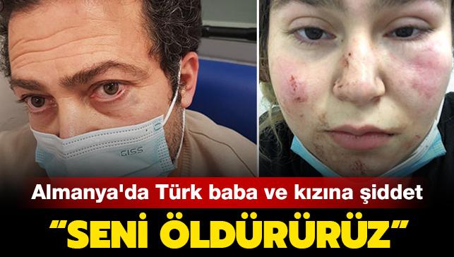 Almanya'da Trk baba ve kzna iddet: Seni ldrrz