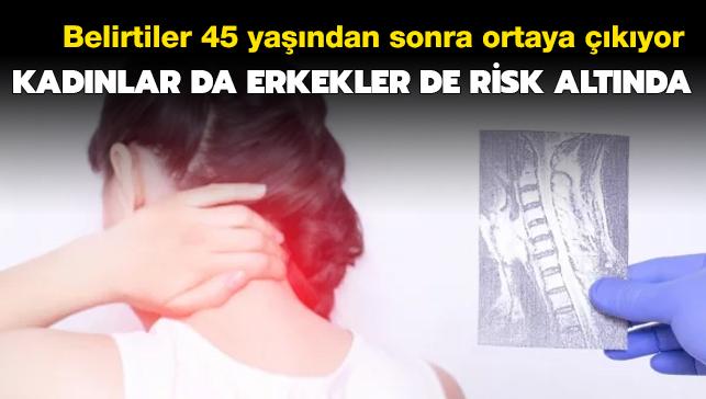 Kadnlarda da erkeklerde de grlyor! Belirtiler 45 yandan sonra ortaya kyor