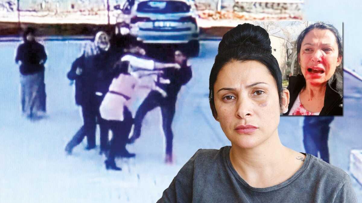 Komusunun yzne kalem saplad! retmen bu hale getirdi