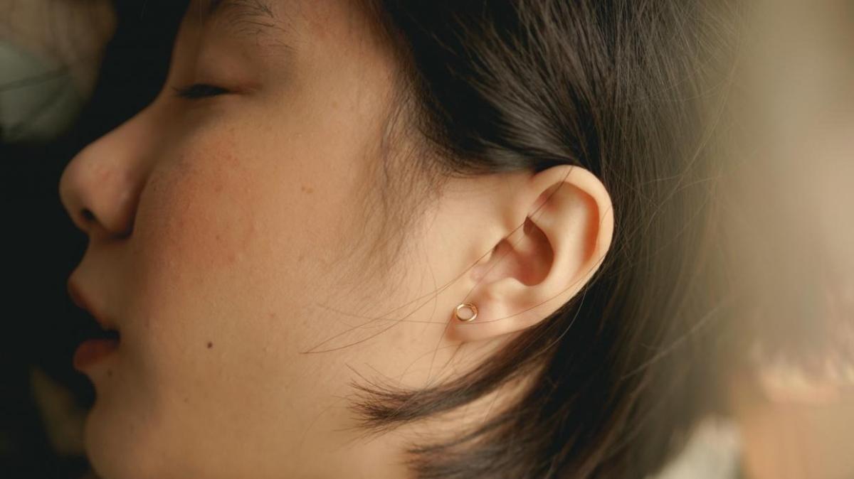 in'de yeni estetik trendi: Elf kulaklar