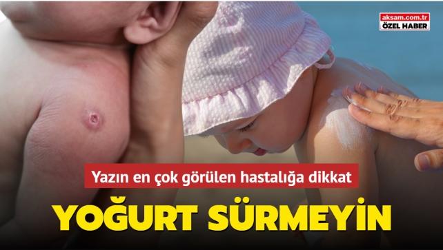 uzmanlar uyardi isilige yogurt surmeyin iste isilige iyi gelen 10 oneri