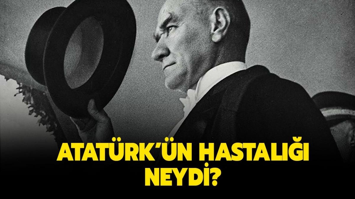 Siroz hastalığı nedir, belirtileri nelerdir" Atatürk'ün hastalığı neydi" 