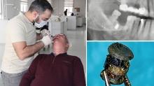 Diş tedavisinde gerçeği öğrendi! Yanağına saplanan metal ile 15 yıl yaşadı