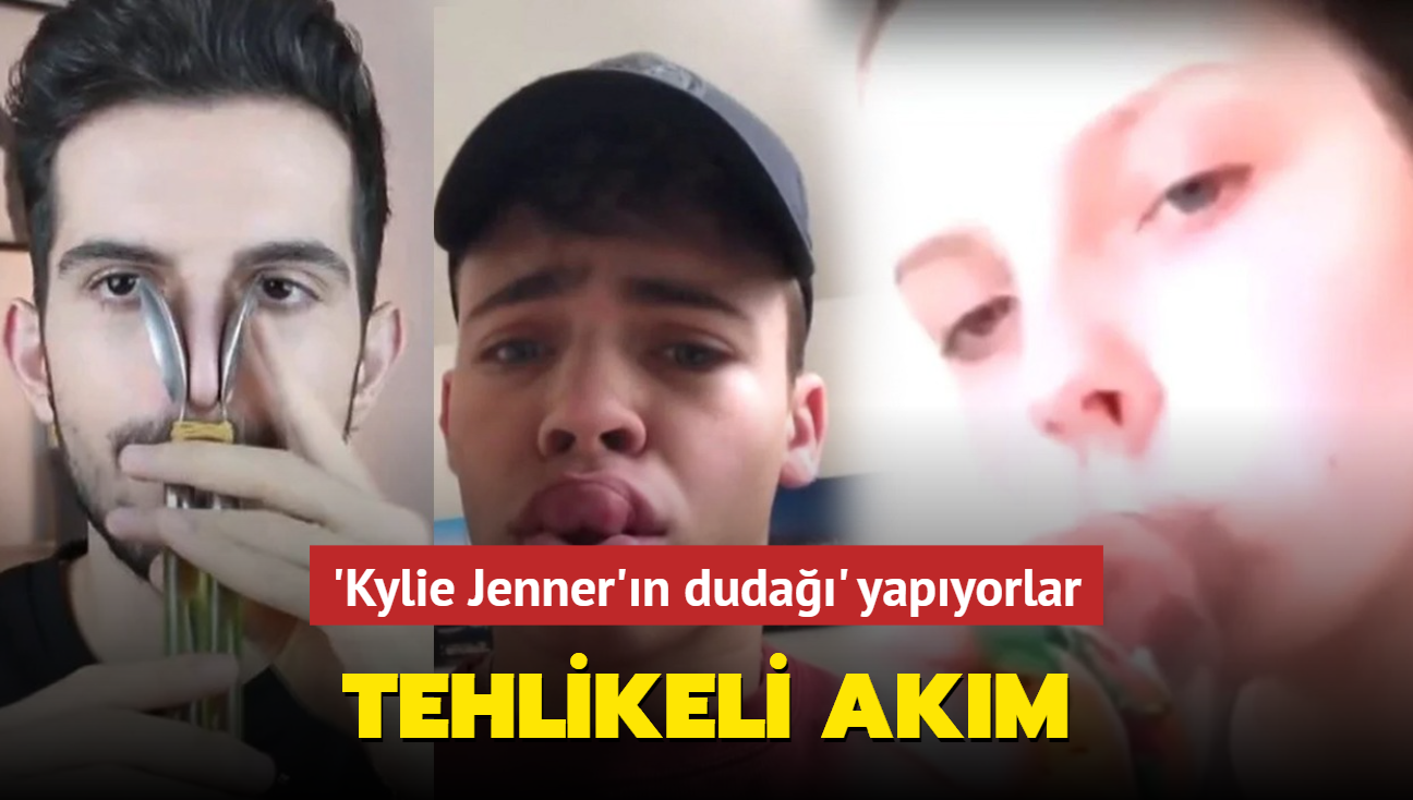 Sosyal medyada tehlikeli akım! 'Kylie Jenner'ın dudağı' yapıyorlar... Sakın denemeyin