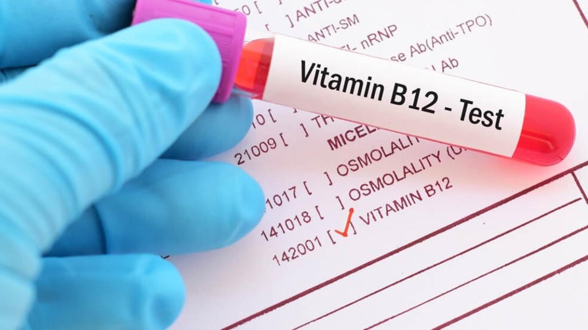 B12 vitamini ne ie yarar" te vitamin eksikliiniz olduunu gsteren 20 iaret!