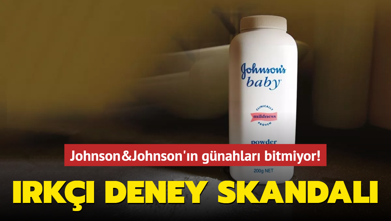 Johnson&Johnson'n gnahlar bitmiyor! Irk deney skandal