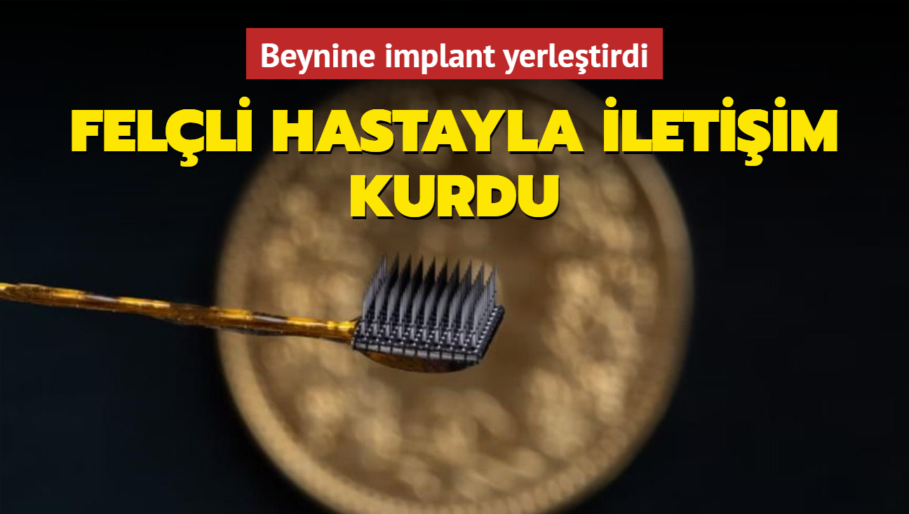 svire'de felli bir hastann beynine yerletirilen bilgisayar arayz sayesinde iletiim kurdu