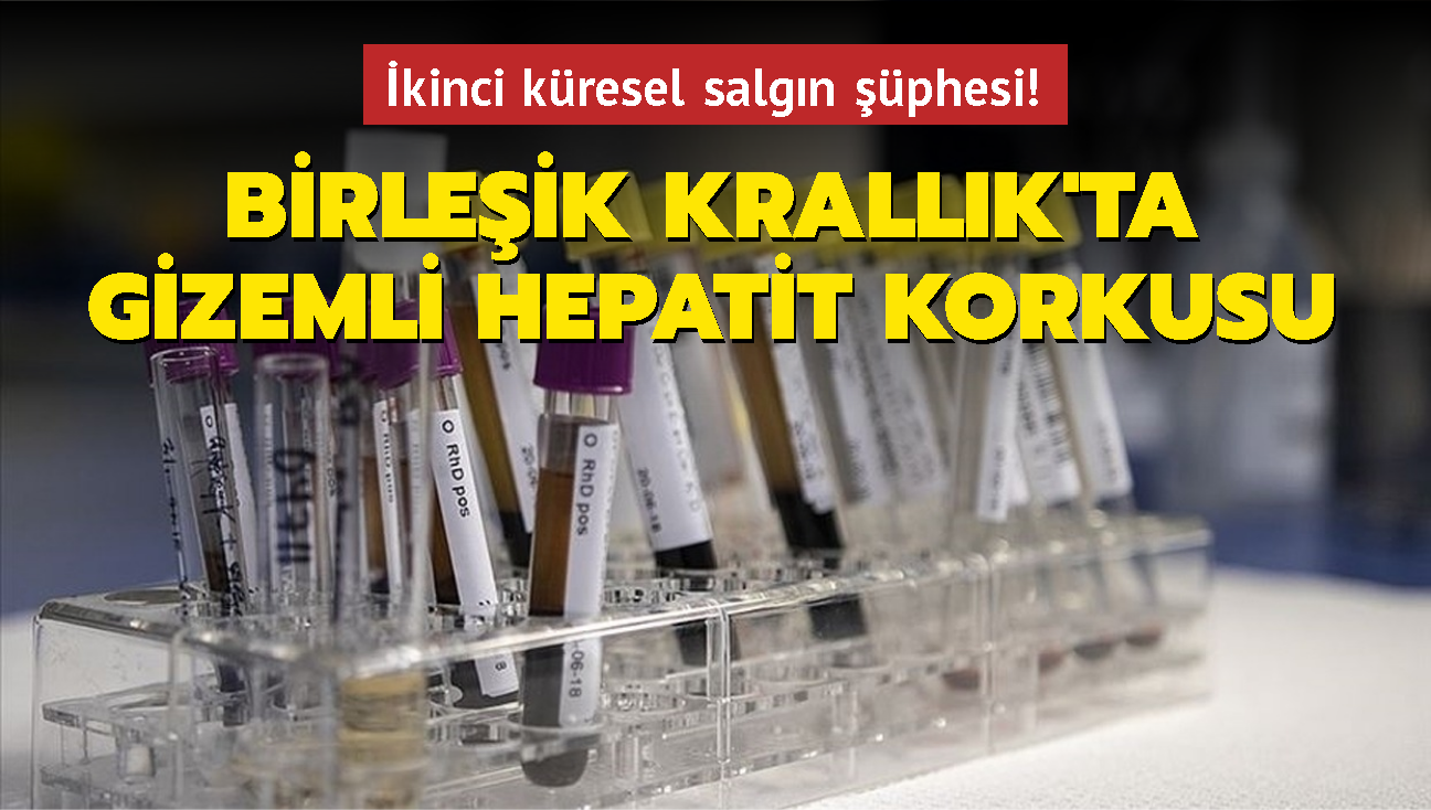 Kovid-19'dan sonra ikinci kresel salgn phesi... Birleik Krallk'ta gizemli hepatit korkusu!