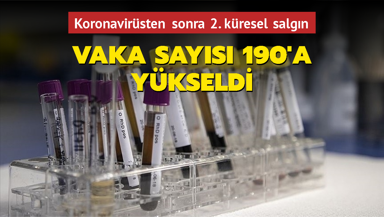 Koronavirsten sonra 2. kresel salgn... Vaka says 190'a ykseldi