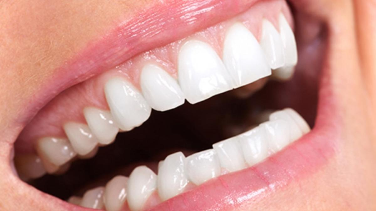Türkiye'nin En İyi Diş Hastaneleri ve Diş Hekimleri Hangileri" Implant All On 4 ve Zirkon Diş Fiyatları…
