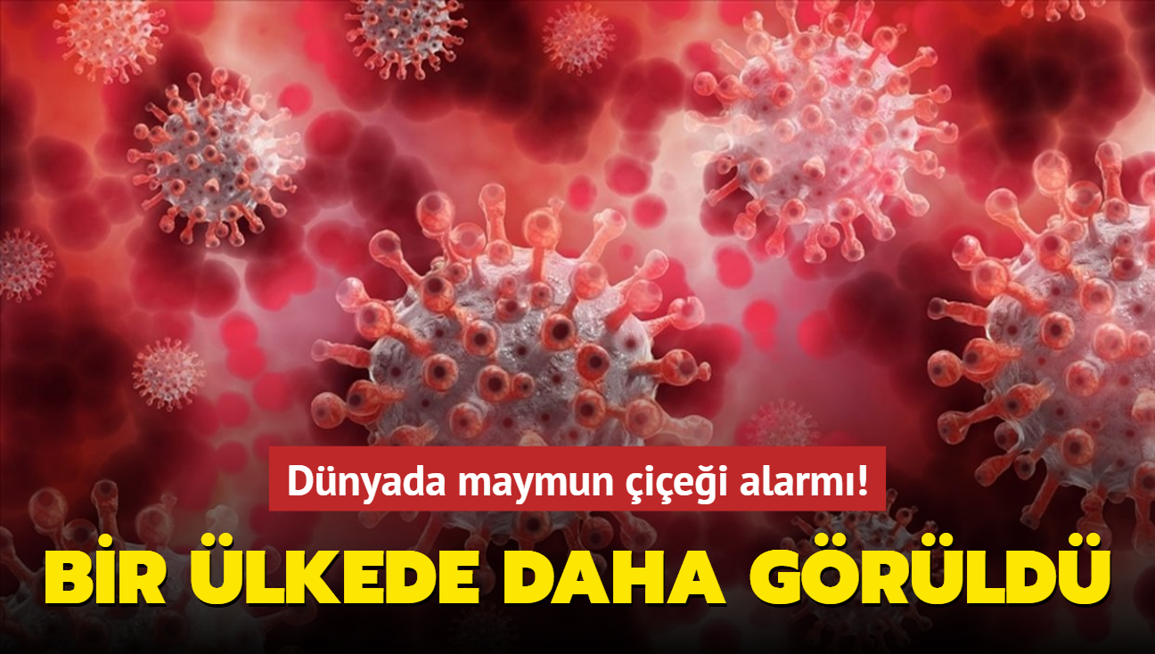 Dnyada maymun iei alarm! Bir lkede daha grld