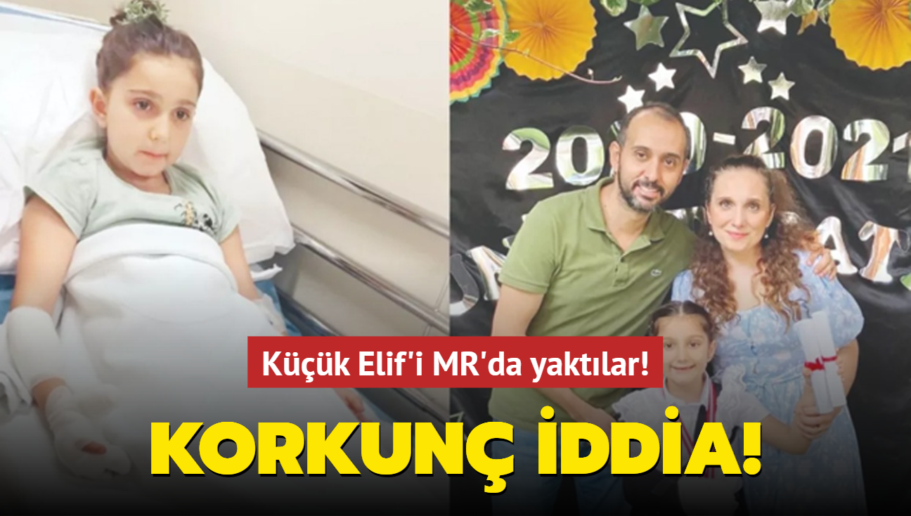 Kk Elif'i MR'da yaktlar! Korkun iddia!