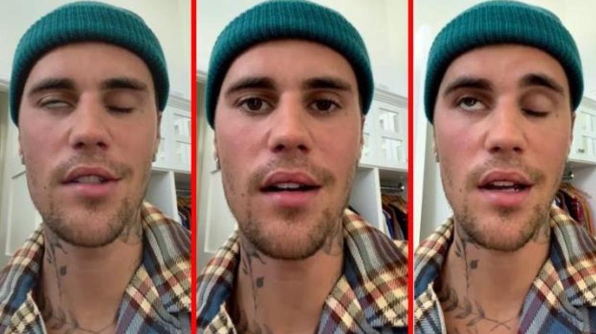 Yüz felci geçiren Justin Bieber son durumu hakkında bilgi verdi