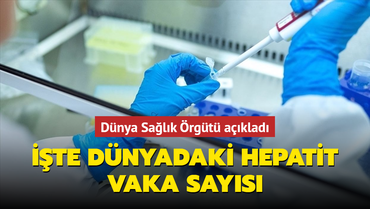 Dnya  Salk rgt aklad... te dnyadaki hepatit vaka says