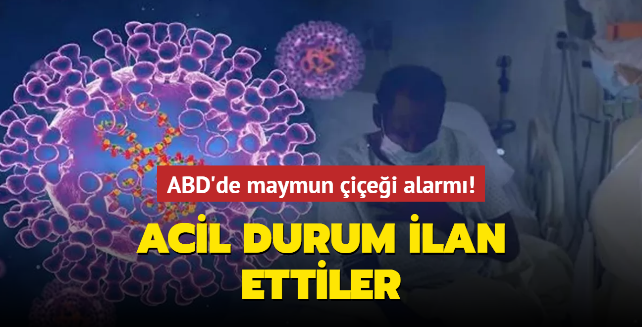 ABD'de maymun iei alarm! Acil durum ilan ettiler