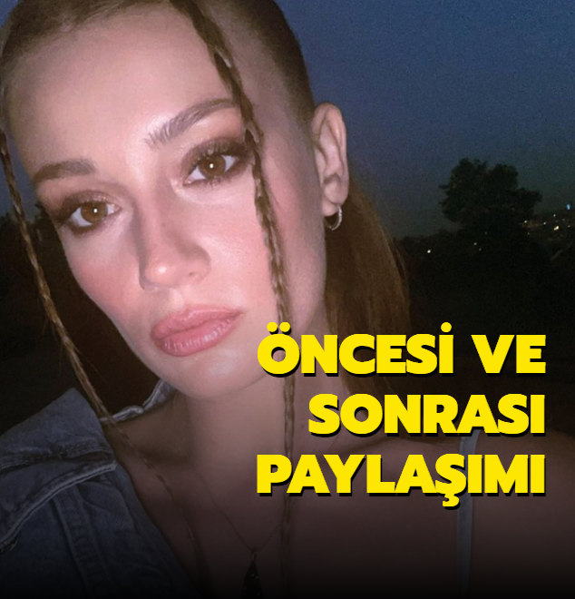 �ncesi ve sonras� payla��m�