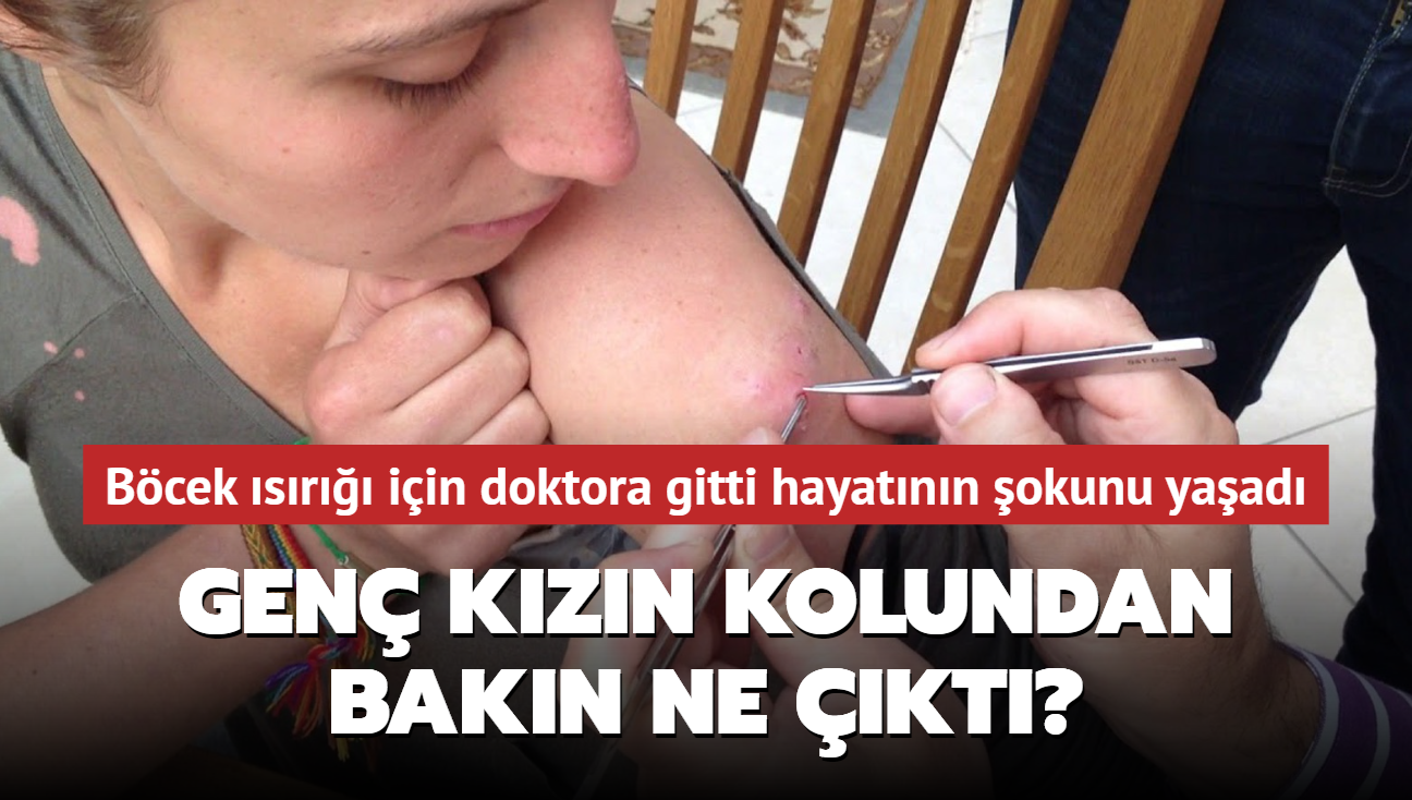 B�cek �s�r��� i�in doktora gitti hayat�n�n �okunu ya�ad�! Gen� k�z�n kolundan bak�n ne ��kt�
