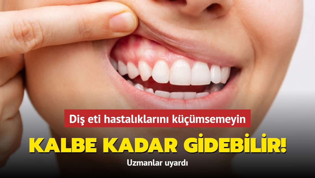 Di eti hastalklarn kmsemeyin... Kalbe kadar gidebilir! Uzmanlar uyard