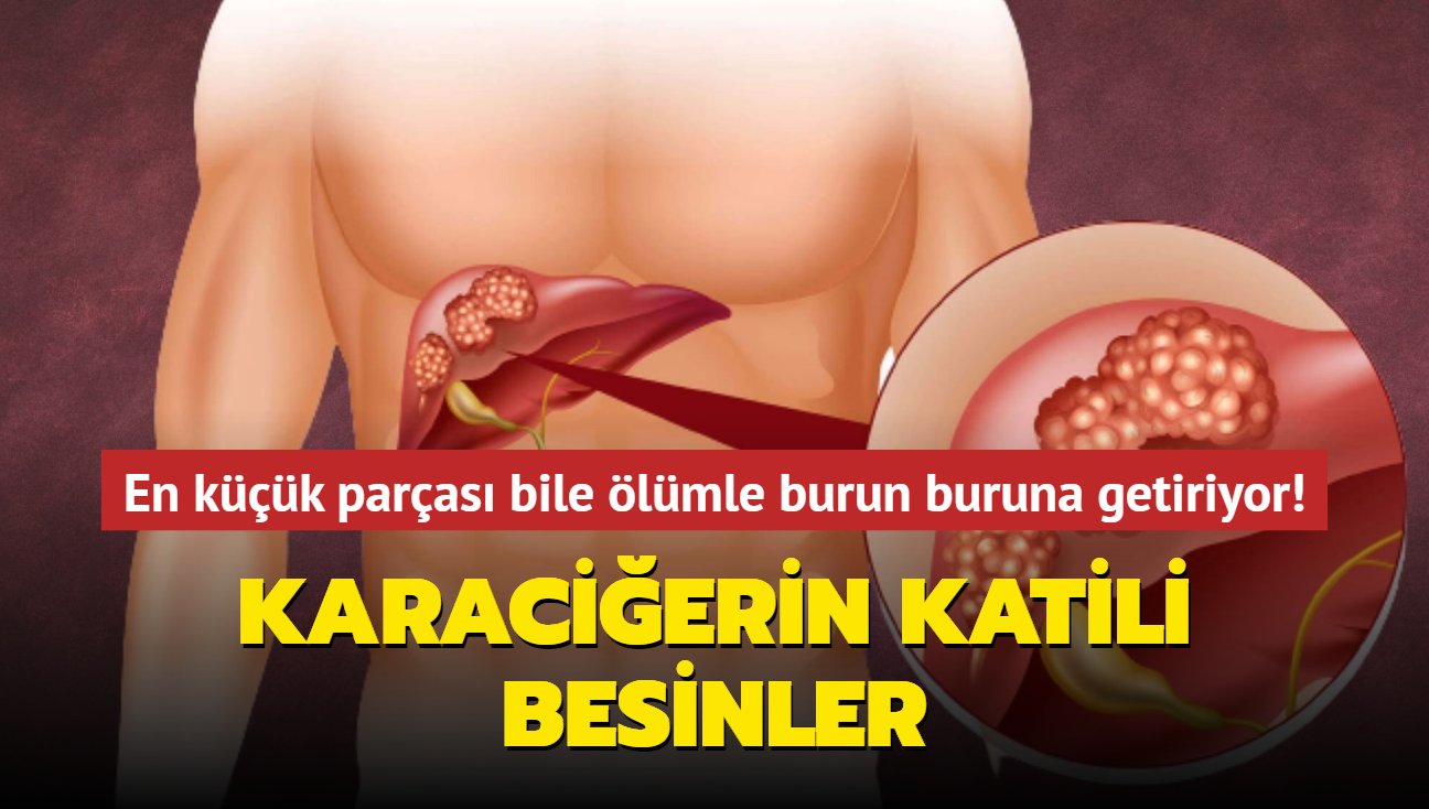 Yediiniz en kk paras bile lmle burun buruna getiriyor! Karacierin katili besinler