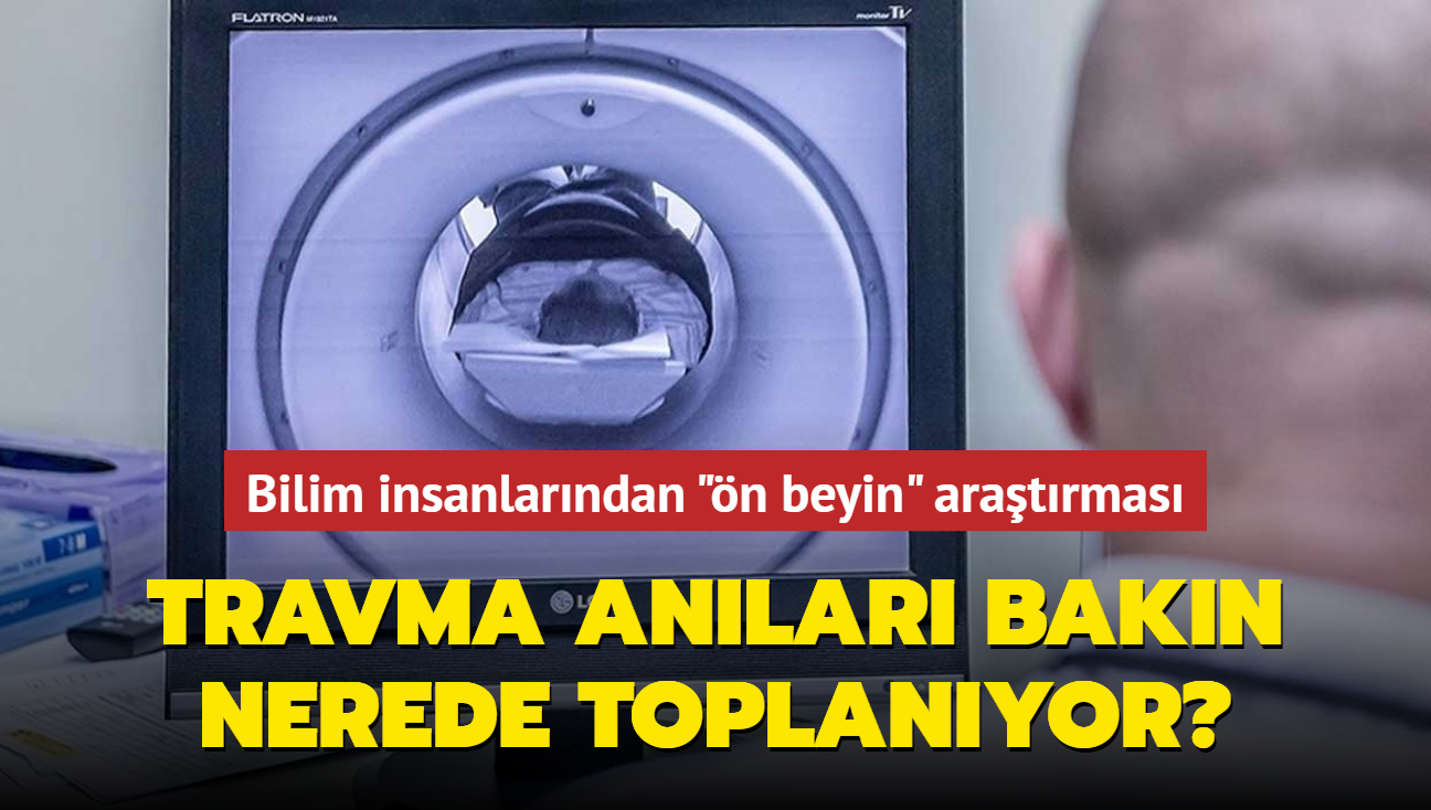 Bilim insanlarndan "n beyin" aratrmas... Travma anlar bakn nerede toplanyor"