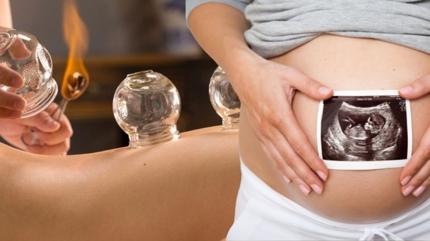 Hacamat hamilelikte ne zaman yaptrlmal? Hacamatn gebelie etkileri...