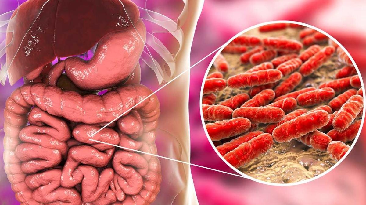 Tembel barsaklar ar gibi altran bomba tavsiyeler! i sebze, yulaf ve meyve tketmek kabzla son verirken metabolizmay hzlandryor