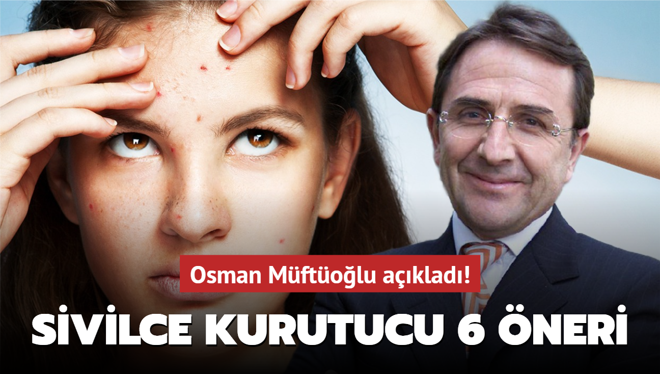 Osman Mftolu aklad! Sivilce kurutucu 6 neri...