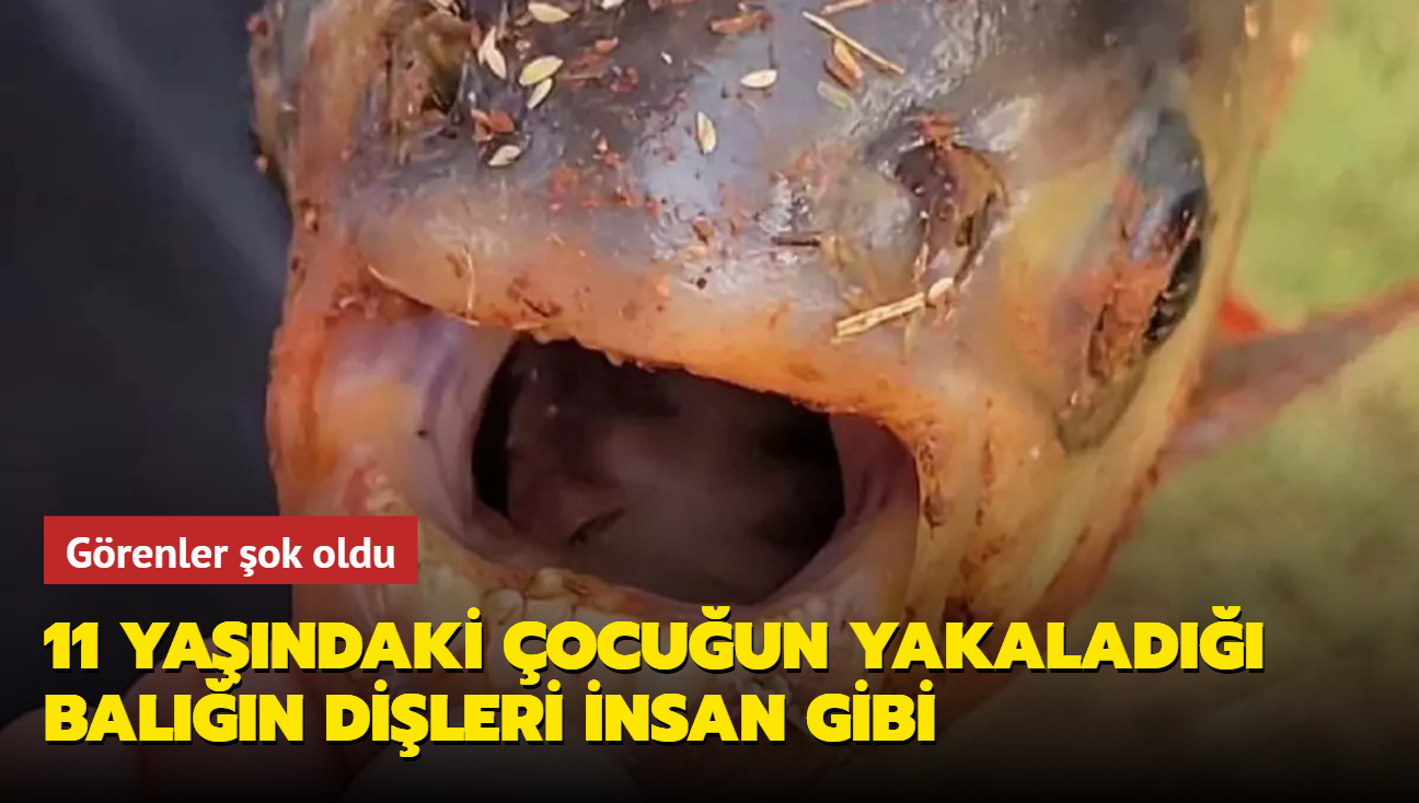 Grenler ok oldu: 11 yandaki ocuun yakalad baln dileri insan gibi