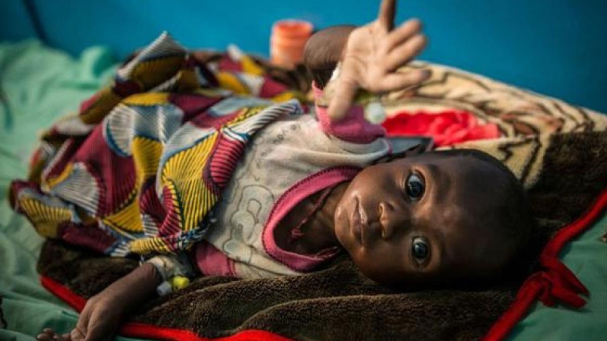 Mali'de 200,000 ocuk alktan lme tehlikesiyle kar karya