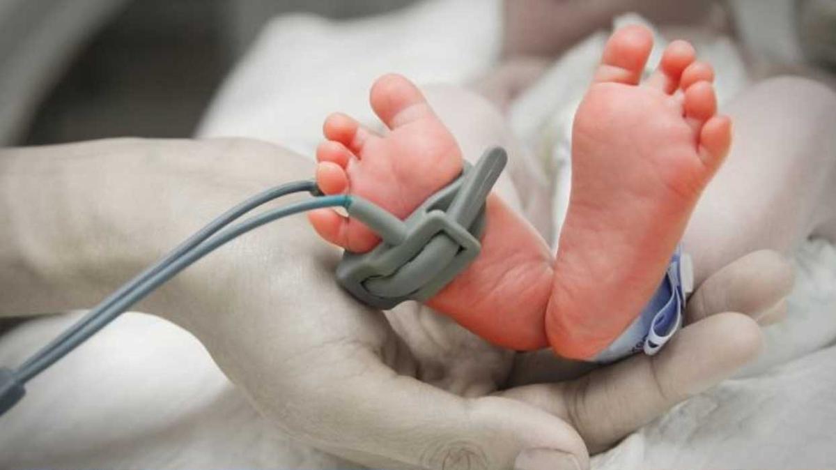 2020'de yaklak 13,4 milyon bebek prematre dodu
