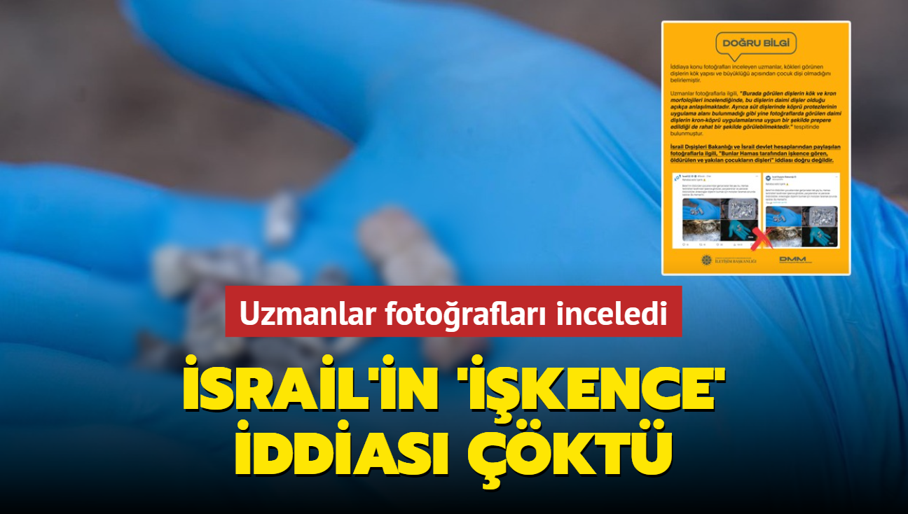 Uzmanlar fotoraflar inceledi! srail'in 'ikence' iddias kt