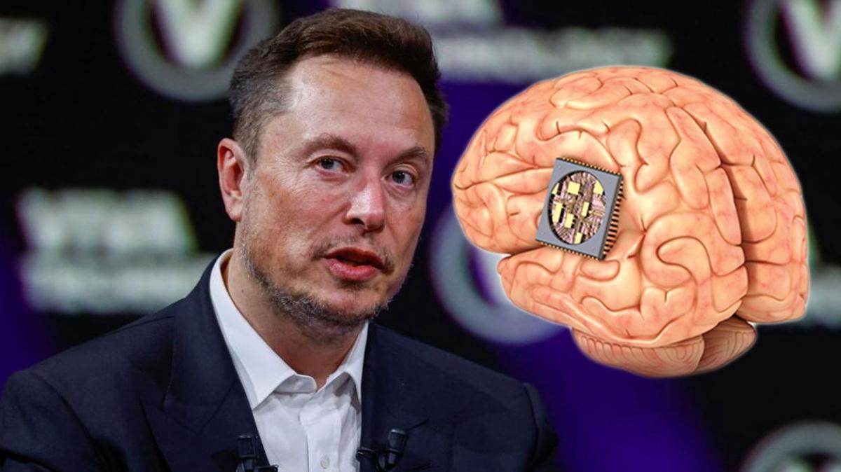 Elon Musk, beynine ip taktracak hasta aryor! 40 ya alt binlerce kii bavurdu