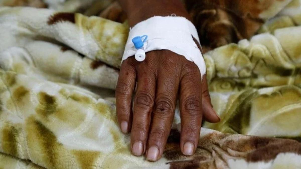Etiyopya'daki kolera salgn: 23 kii ld