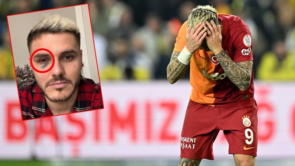 Galatasaray'dan Icardi tepkisi! Fenerbahçe'den cevap gecikmedi