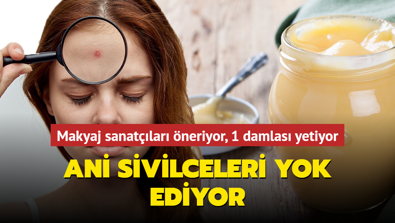 Ani sivilceleri yok eden jel! Makyaj sanatlar neriyor, 1 damlas yeterli