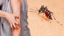 Sivrisinek kantsn geirmenin 3 yolu! Oysa bu kadar basitmi