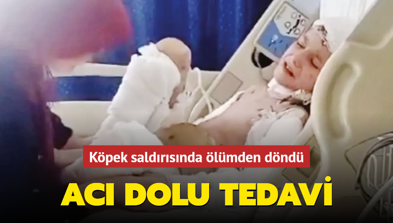 Kpek saldrsnda lmden dnmt... Ac dolu tedavi!