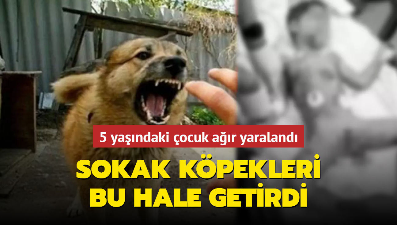 Sokak kpekleri bu hale getirdi