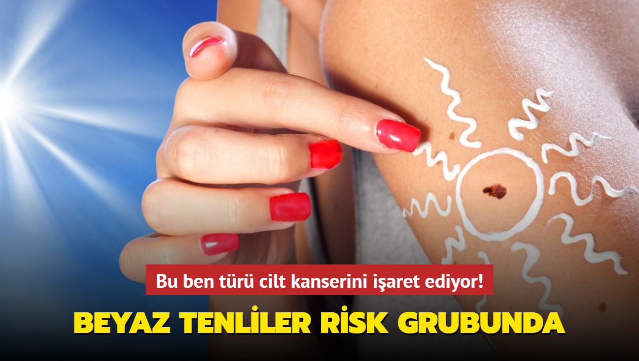 Bu ben tr cilt kanserini iaret ediyor! Beyaz tenliler risk grubunda