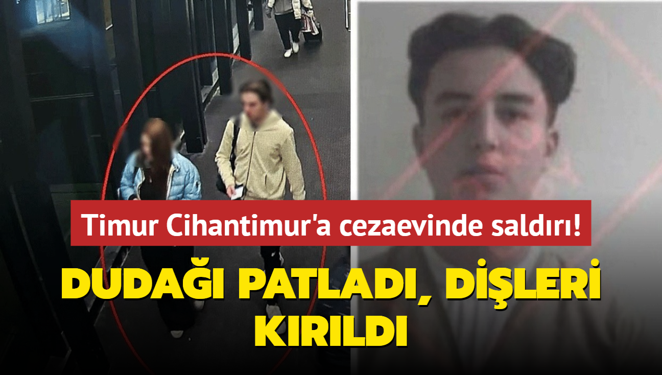 Timur Cihantimur'a cezaevinde saldr! Duda patlad, dileri krld