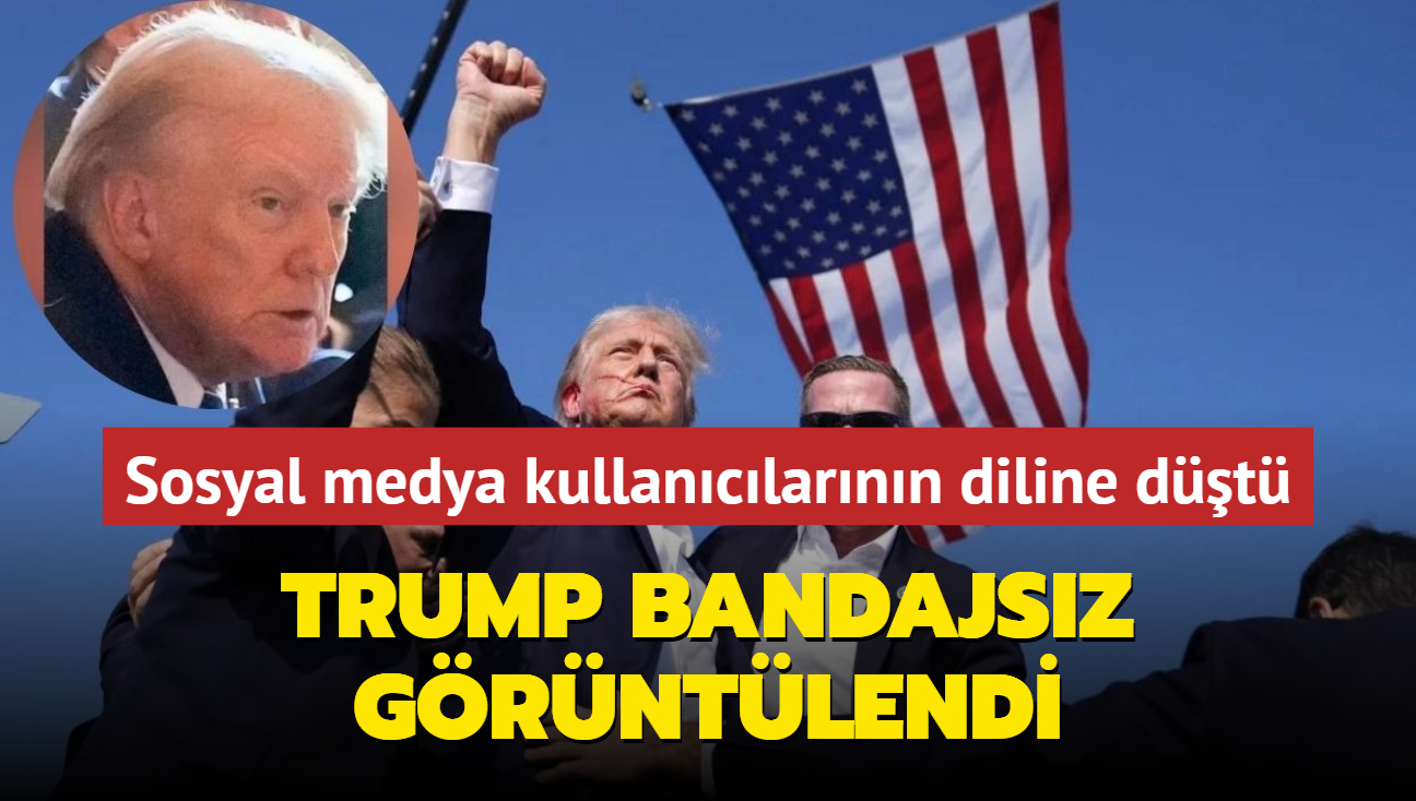 Suikast giriiminden sonra ilk kez bandajsz grntlenen Trump sosyal medyann dilinde