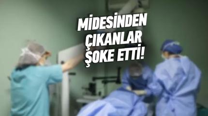 Midesinden kanlar doktorlar oke etti