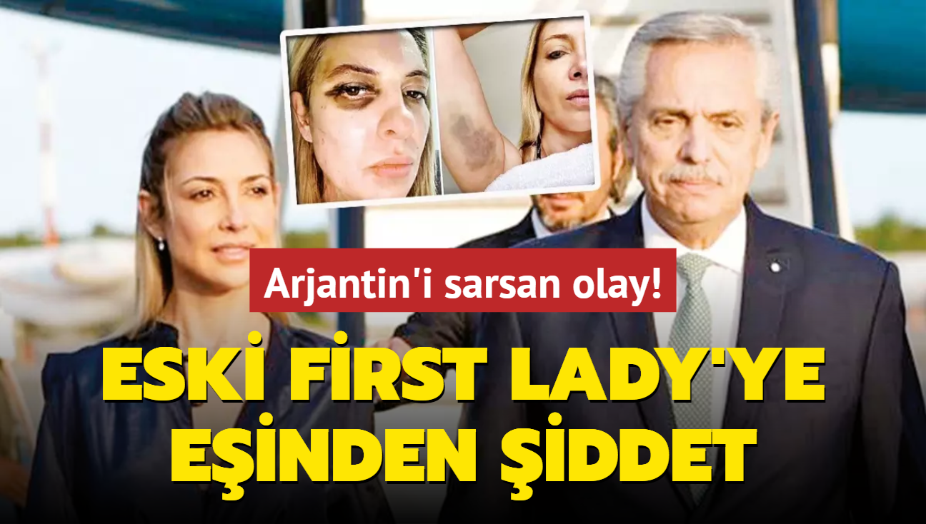 Arjantin'i sarsan olay! Eski First Lady'ye einden iddet